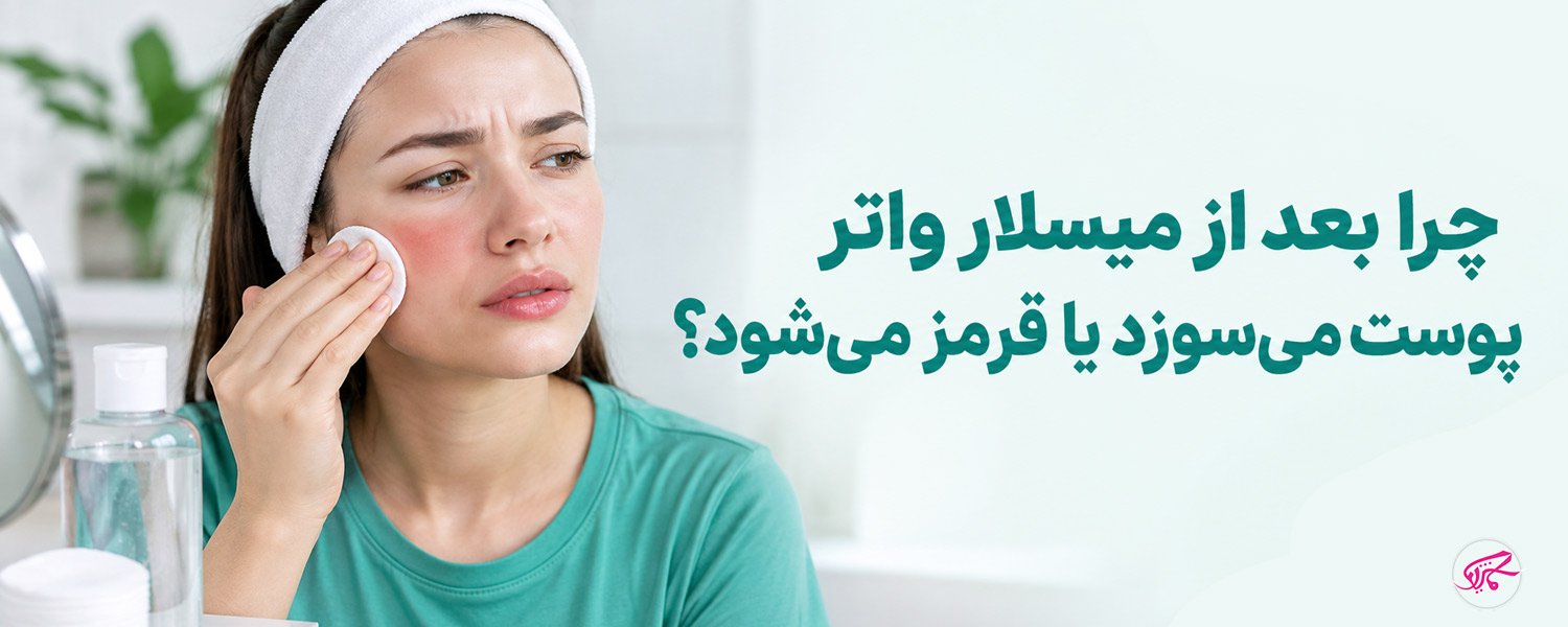 چرا بعد از میسلار واتر پوست می‌سوزد یا قرمز می‌شود؟