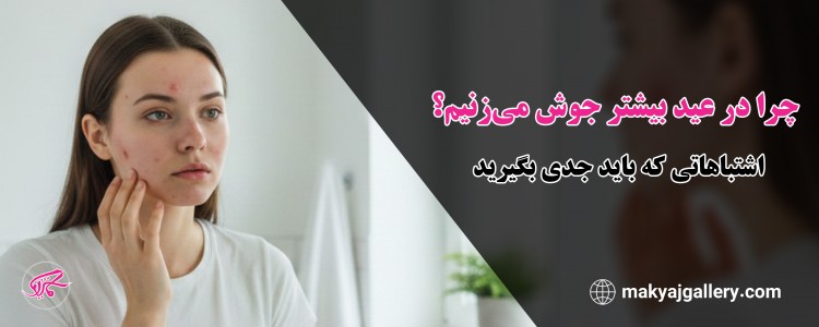 چرا در عید بیشتر جوش می‌زنیم؟ اشتباهاتی که باید جدی بگیرید