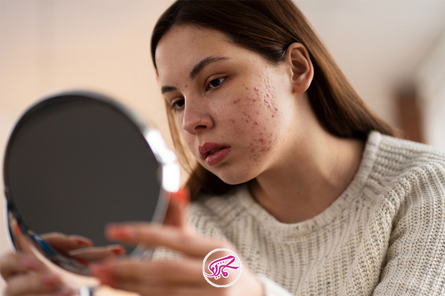 آیا ابرسان صورت باعث کاهش لک صورت می شود؟ 1