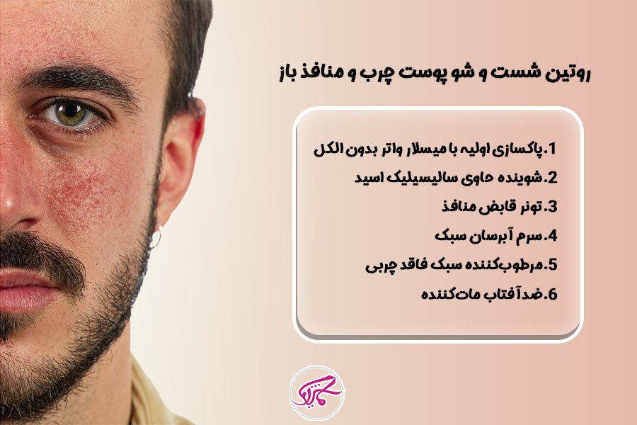 مراحل روتین شستشوی صورت برای پوست چرب و منافذ باز