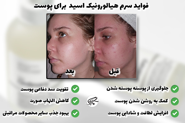 فواید سرم هیالورونیک اسید اوردینری برای پوست