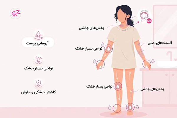 کدام قسمت‌های بدن به لوسیون نیاز دارند؟