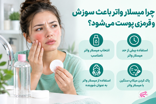 چرا میسلار واتر باعث سوزش و قرمزی پوست می‌شود؟